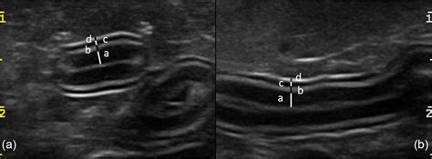 measurement of small intestine thickness cats|cat abdominal ultrasound measurements.